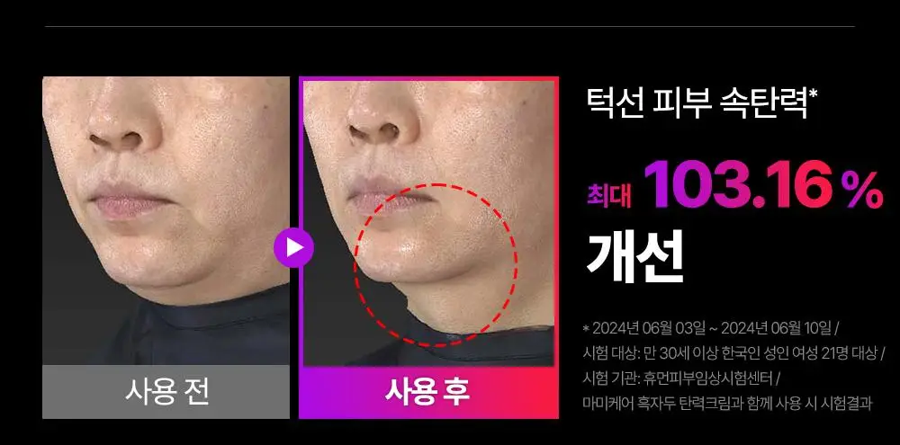 [7월 올영픽/이중턱개선] 마미케어 EMS 브이쎄라 (6 COLOR) 상세페이지 40